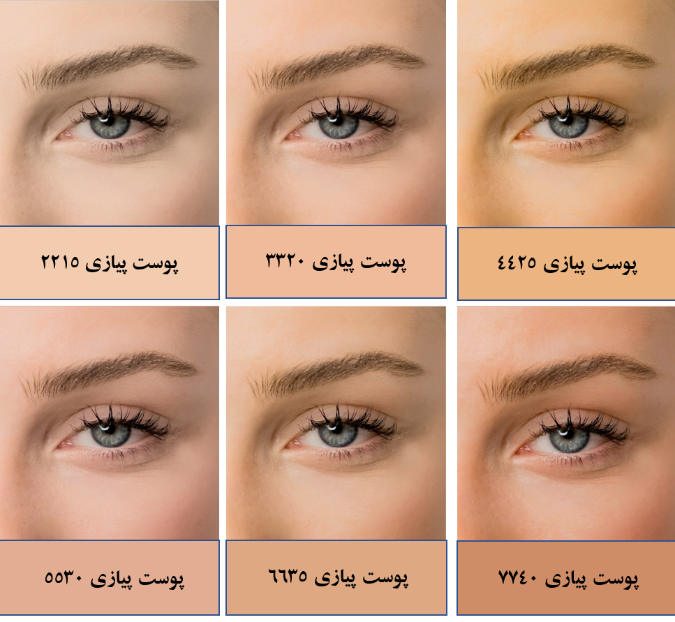 آنالیز محصول